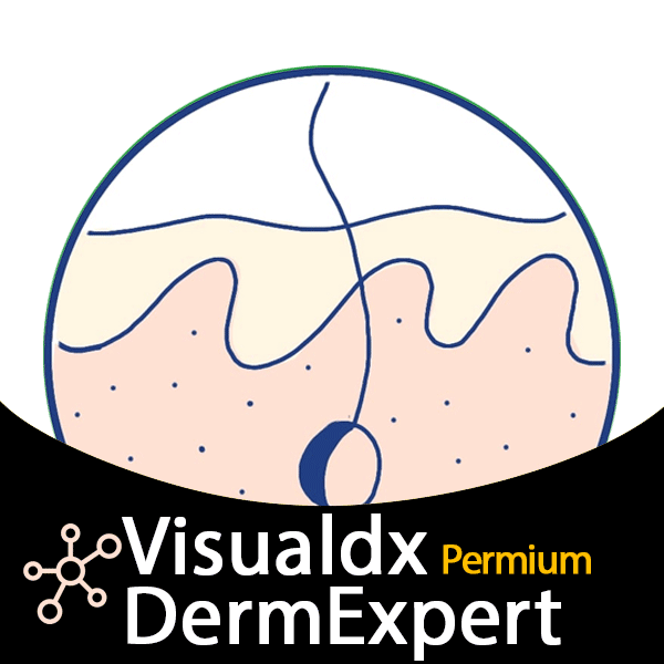Visualdx